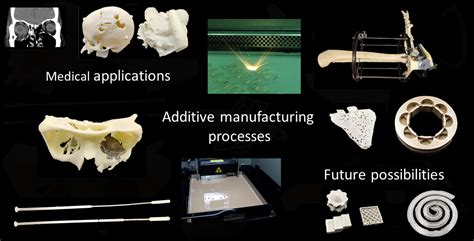  Delrin: Un thermoplastique d'ingénierie aux performances exceptionnelles pour la fabrication additive et les applications médicales!